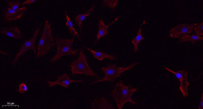 TNF-α rabbit pAb – Figure 1 of 1