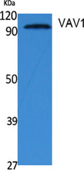Western Blot analysis of extracts from NIH-3T3 cells, using VAV1 Polyclonal Antibody. Secondary antibody(catalog#:RS0002) was diluted at 1:20000