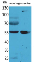 Western Blot analysis of mouse lung, mouse liver cells using ALDH1A1 Polyclonal Antibody. Secondary antibody(catalog#:RS0002) was diluted at 1:20000