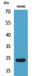 Western Blot analysis of SW480 cells using FGF-9 Polyclonal Antibody. Secondary antibody(catalog#:RS0002) was diluted at 1:20000