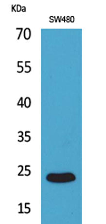 Western Blot analysis of SW480 cells using FGF-9 Polyclonal Antibody. Secondary antibody(catalog#:RS0002) was diluted at 1:20000