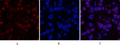 MDM2 rabbit pAb – Figure 1 of 4