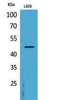 Western Blot analysis of L929 cells using CD116 Polyclonal Antibody. Secondary antibody(catalog#:RS0002) was diluted at 1:20000