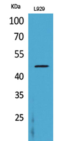 Western Blot analysis of L929 cells using CD116 Polyclonal Antibody. Secondary antibody(catalog#:RS0002) was diluted at 1:20000