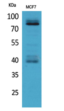 Western Blot analysis of MCF7 cells using IL-1RI Polyclonal Antibody. Secondary antibody(catalog#:RS0002) was diluted at 1:20000