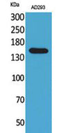 Western Blot analysis of AD293 cells using NTE Polyclonal Antibody. Secondary antibody(catalog#:RS0002) was diluted at 1:20000