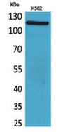 Western Blot analysis of K562 cells using Cryopyrin Polyclonal Antibody. Secondary antibody(catalog#:RS0002) was diluted at 1:20000
