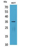 Western Blot analysis of MCF7 cells using IL-12A p35 Polyclonal Antibody. Secondary antibody(catalog#:RS0002) was diluted at 1:20000
