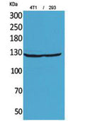 Western Blot analysis of 4T1, 293 cells using Integrin αD Polyclonal Antibody. Secondary antibody(catalog#:RS0002) was diluted at 1:20000