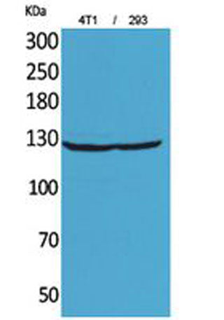 Western Blot analysis of 4T1, 293 cells using Integrin αD Polyclonal Antibody. Secondary antibody(catalog#:RS0002) was diluted at 1:20000