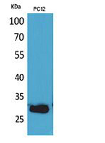 Western Blot analysis of PC12 cells using CD200 Polyclonal Antibody. Secondary antibody(catalog#:RS0002) was diluted at 1:20000