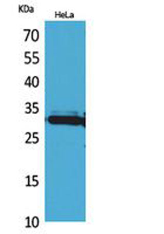 Western Blot analysis of HeLa cells using IL-33 Polyclonal Antibody. Secondary antibody(catalog#:RS0002) was diluted at 1:20000