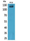 Western Blot analysis of PC12 cells using UBA1 Polyclonal Antibody. Secondary antibody(catalog#:RS0002) was diluted at 1:20000