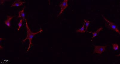 Immunofluorescence analysis of A549. 1,primary Antibody(red) was diluted at 1:200(4°C overnight). 2, Goat Anti Rabbit IgG (H&L) - Alexa Fluor 594 Secondary antibody was diluted at 1:1000(room temperature, 50min).3, Picture B: DAPI(blue) 10min.