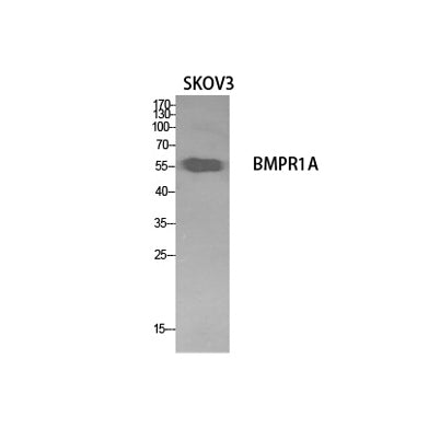 Western Blot analysis of SKOV3 cells using CD292 Polyclonal Antibody. Secondary antibody(catalog#:RS0002) was diluted at 1:20000