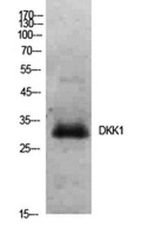 Western Blot analysis of Hela cells using Dkk-1 Polyclonal Antibody. Secondary antibody(catalog#:RS0002) was diluted at 1:20000