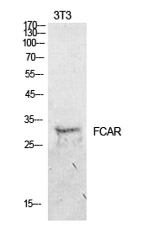 Western Blot analysis of NIH-3T3 cells using CD89 Polyclonal Antibody. Secondary antibody(catalog#:RS0002) was diluted at 1:20000