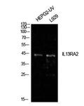 Western Blot analysis of HepG2(UV), L929 cells using IL-13Rα2 Polyclonal Antibody. Antibody was diluted at 1:500. Secondary antibody(catalog#:RS0002) was diluted at 1:20000