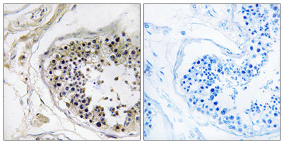Cystatin 8 rabbit pAb – Figure 1 of 1