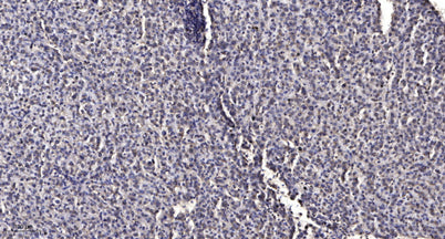 PAK4 (phospho Ser474) rabbit pAb – Figure 1 of 2
