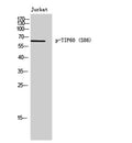 Western Blot analysis of Jurkat cells using Phospho-TIP60 (S86) Polyclonal Antibody