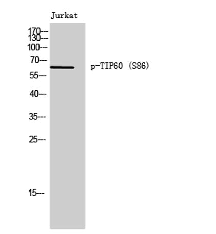 Western Blot analysis of Jurkat cells using Phospho-TIP60 (S86) Polyclonal Antibody