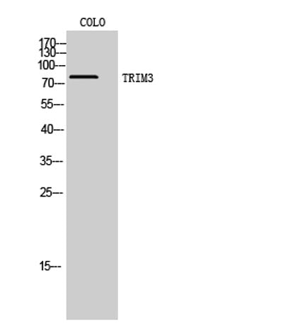 Western Blot analysis of COLO cells using TRIM3 Polyclonal Antibody. Secondary antibody(catalog#:RS0002) was diluted at 1:20000