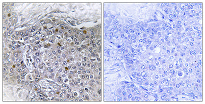 BS69 rabbit pAb – Figure 1 of 1
