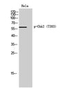 Chk2 (phospho Thr383) rabbit pAb – Figure 1 of 4