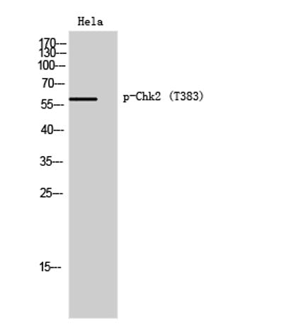 Chk2 (phospho Thr383) rabbit pAb – Figure 1 of 4