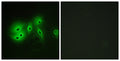 Immunofluorescence analysis of A549 cells, using ADCY8 Antibody. The picture on the right is blocked with the synthesized peptide.