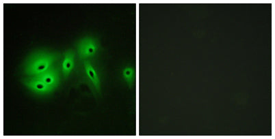 Immunofluorescence analysis of A549 cells, using ADCY8 Antibody. The picture on the right is blocked with the synthesized peptide.