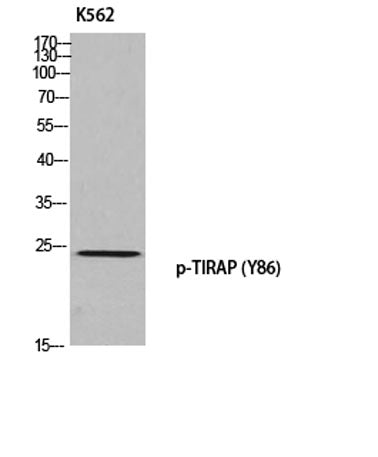 Western blot analysis of K562 using p-TIRAP (Y86) antibody.