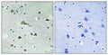 TIRAP rabbit pAb – Figure 1 of 1