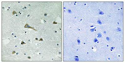 TIRAP rabbit pAb – Figure 1 of 1