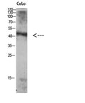 Western Blot analysis of Colo using Antibody diluted at 1:1000. Secondary antibody(catalog#:RS0002) was diluted at 1:20000