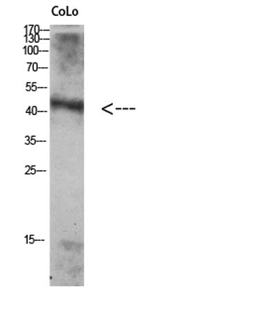 Western Blot analysis of Colo using Antibody diluted at 1:1000. Secondary antibody(catalog#:RS0002) was diluted at 1:20000