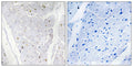 Alpha-protein Kinase 2 rabbit pAb – Figure 1 of 1