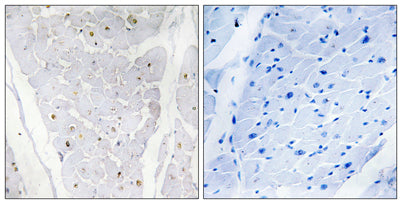 Alpha-protein Kinase 2 rabbit pAb – Figure 1 of 1