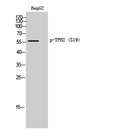 Western Blot analysis of HepG2 cells using Phospho-TPH2 (S19) Polyclonal Antibody