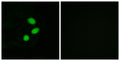 Immunofluorescence analysis of MCF7 cells, using TSH2 Antibody. The picture on the right is blocked with the synthesized peptide.