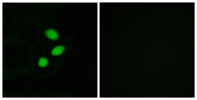 Immunofluorescence analysis of MCF7 cells, using TSH2 Antibody. The picture on the right is blocked with the synthesized peptide.