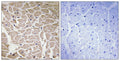 COL16A1 rabbit pAb – Figure 1 of 1