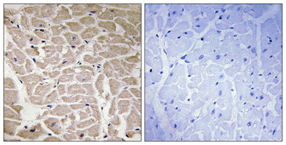COL16A1 rabbit pAb – Figure 1 of 1