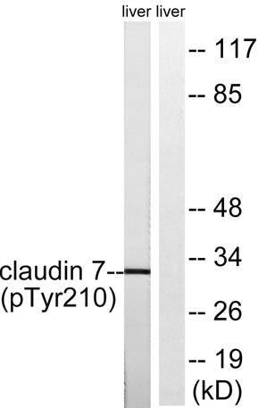 Western blot analysis of lysates from rat liver, using Claudin 7 (Phospho-Tyr210) Antibody. The lane on the right is blocked with the phospho peptide.