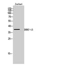 Western Blot analysis of Jurkat cells using DHHC-15 Polyclonal Antibody