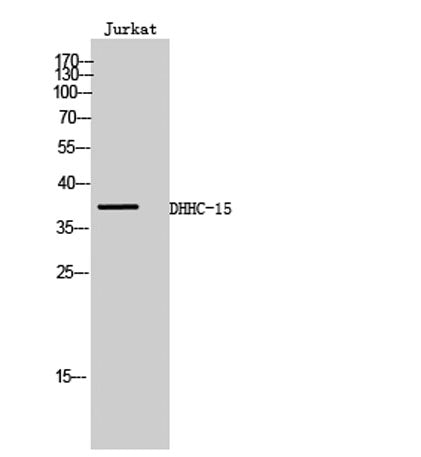 Western Blot analysis of Jurkat cells using DHHC-15 Polyclonal Antibody