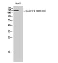 EphA2/3/4 (phospho Tyr588/596) rabbit pAb – Figure 1 of 4