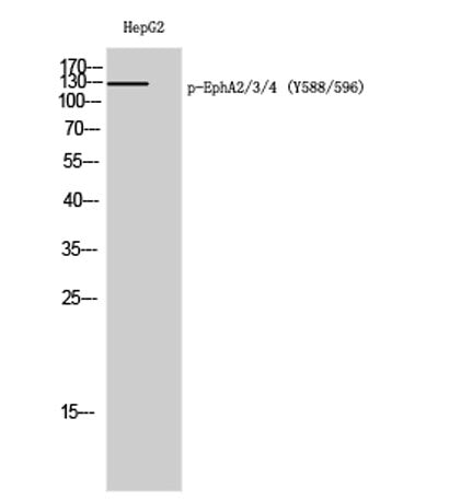 EphA2/3/4 (phospho Tyr588/596) rabbit pAb – Figure 1 of 4