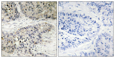 ERK 8 rabbit pAb – Figure 1 of 1